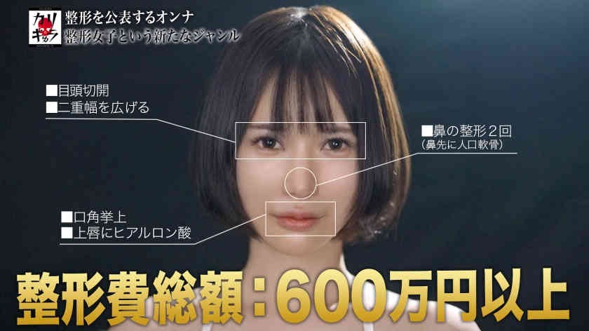 277DCV-159